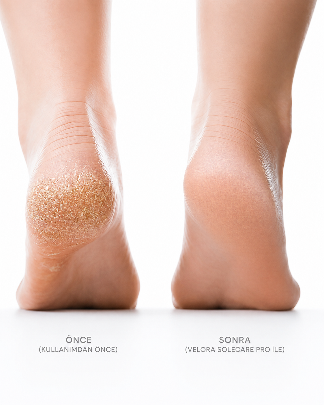 Vellora SoleCare Pro
